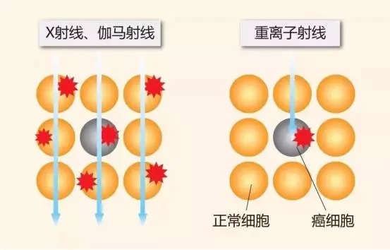 質(zhì)子重離子技術(shù)醫(yī)療險可以報銷嗎？